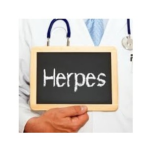 What Are Common Herpes Symptoms?